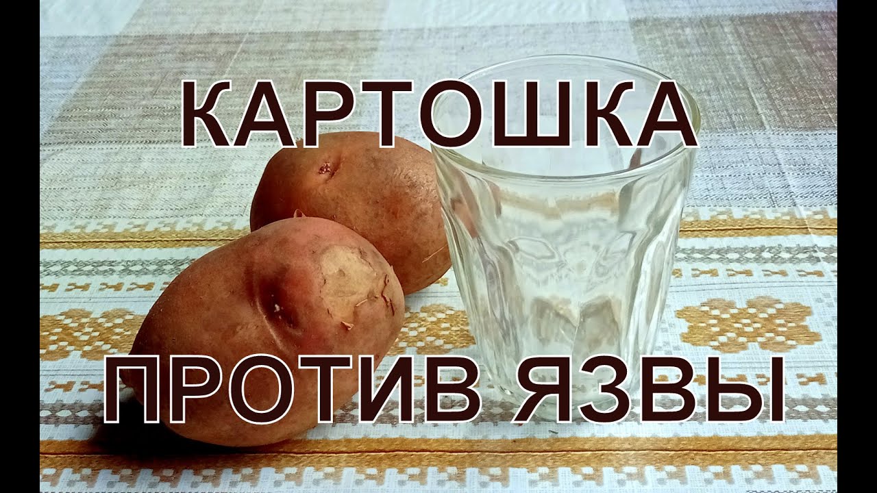 сок сырого картофеля при язве и холецистите
