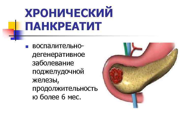 панкреолипоматоз