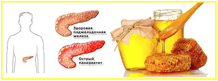 можно ли пить мед при панкреатите